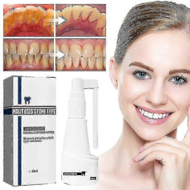 30ml Calculus Dissolving Dental Spray Oral Tooth Cleaner Tartar Remover Tw
