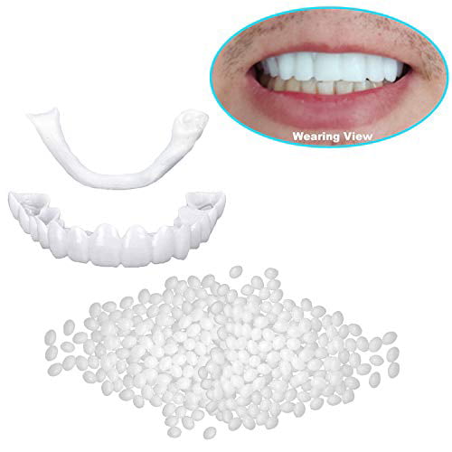 Denture Top Veneers and Thermal Beads for Temporary Tooth Teaching Repair, Customizable Up Teeth Braces - Walmart.com