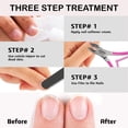 thumbnail image 3 of Professional Cuticle Trimmer Nail Cuticle Cutter Stainless Steel Cuticle Nippers with Sharp Blades of Cuticle Remover Clippers Manicure Tools Double Spring - Pedicure Nail Tools (Pink - 4 Pack), 3 of 7