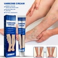 Face SerumCreamMakeupBeautyVenoheal Varicose Vein Ease Paste, Varicose Veins Paste, Varicose