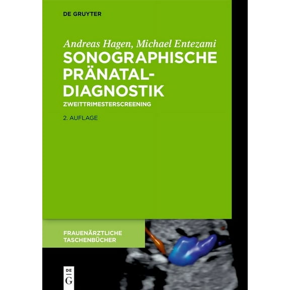FrauenÃ¤rztliche TaschenbÃ¼cher Sonographische PrÃ¤nataldiagnostik: Zweittrimesterscreening, (Hardcover)