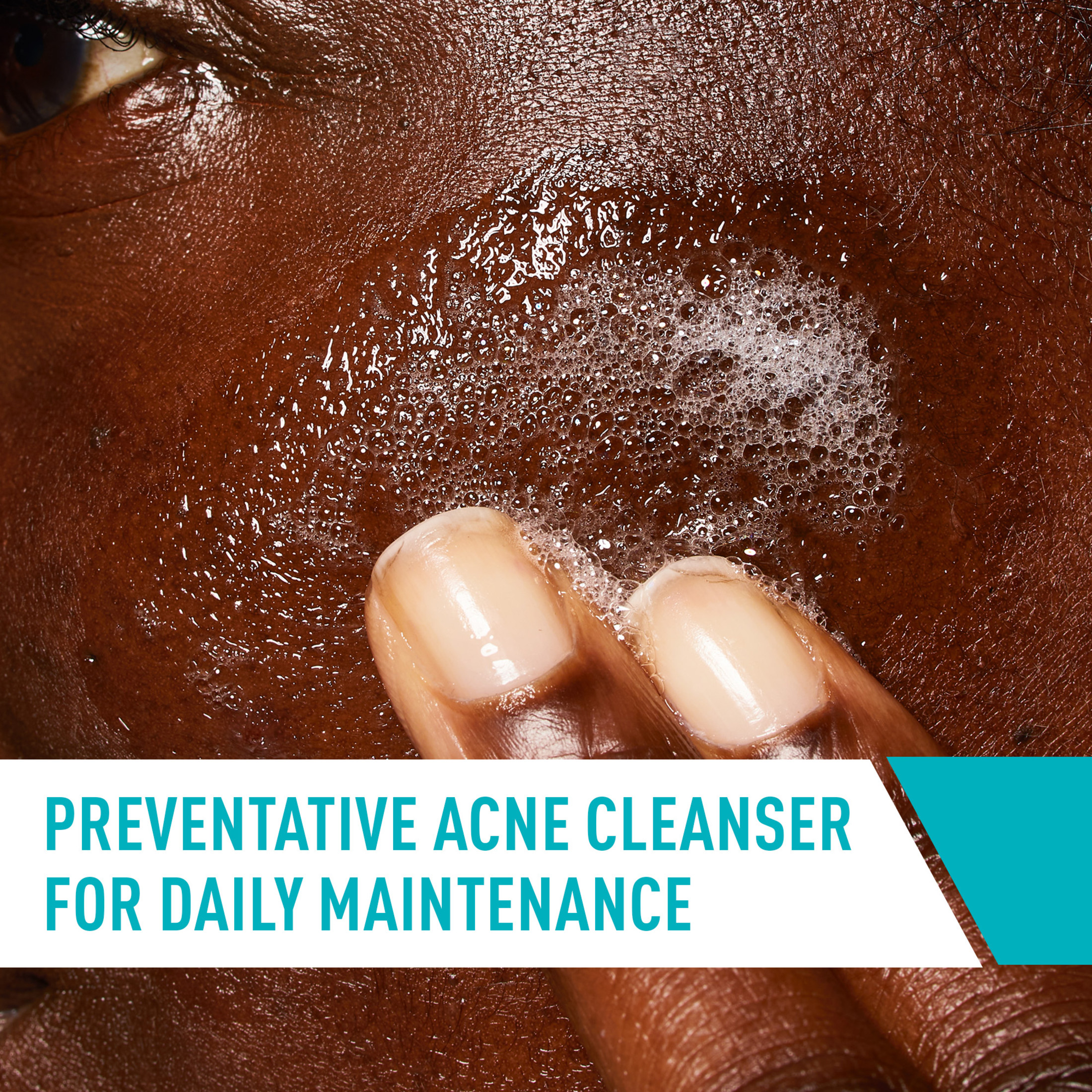 CeraVe Acne Control Cleanser with Salicylic Acid photo 8