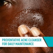 CeraVe Skin Care Acne Control Face Cleanser with 2% Salicylic Acid Clears Acne Blackheads Pores