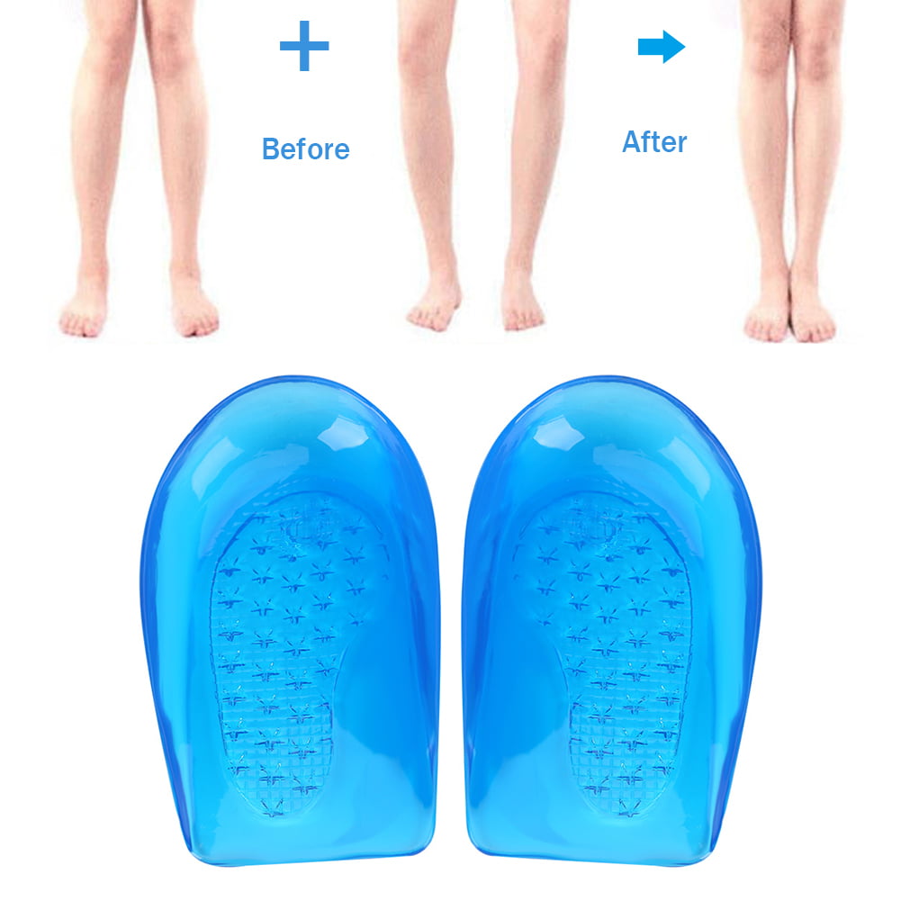 Orthotic Insoles Arch Support Plantar Fasciitis O-Type Legs Correction Pads 