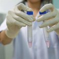 thumbnail image 4 of Conical Centrifuge Tubes 15ML, 100 Pcs Sterile Plastic Test Tubes with Screw Caps, Polypropylene Container, 4 of 5