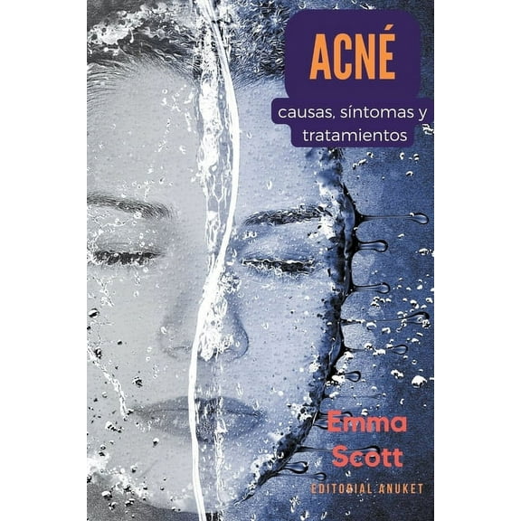 Acné: Causas, Síntomas y Tratamientos (Paperback)