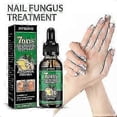 thumbnail image 5 of Jaysuing Ginger Nail Care Solution 30ml Nail Fungus Repair Hand, Foot Nail Care Soft Nail Bright, 5 of 5