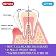 thumbnail image 2 of Gum Foam Mousse Care Gum Deep Cleaning Teeth Dirt Tooth Cleaning Tooth Protection Mousse Toothpaste, 2 of 4