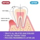 thumbnail image 2 of Gum Foam Mousse Care Gum Deep Cleaning Teeth Dirt Tooth Cleaning Tooth Protection Mousse Toothpaste, 2 of 4