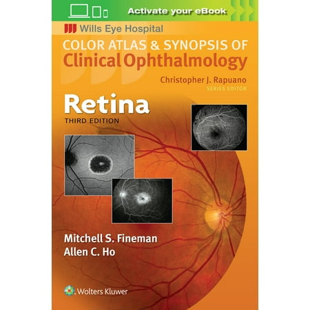 UPC: 9781496363084 | Color Atlas and Synopsis of Clinical Ophthalmology: Retina (Paperback)