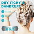 thumbnail image 4 of Dandruff Shampoo - Itchy & Dry Scalp Treatment, Psoriasis Shampoo for Women & Men, Scalp Anti Dandruff Relief - Daily Hair Shampoo, 4 of 7
