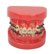 Professional Dental Demonstration Orthodontic Model with Metal Wires and Bracket for Teaching Learning YZRC