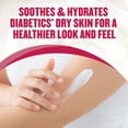 thumbnail image 5 of Gold Bond Diabetics' Dry Skin Relief Body Lotion, 13 oz., With Aloe to Moisturize & Soothe, 5 of 10