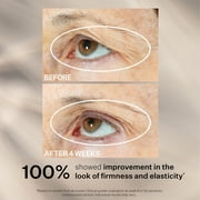 StriVectin Peptight 360˚ Tightening Eye Serum, 1 fl oz