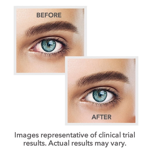 LUMIFY Redness Reliever Eye Drops Itchy Eyes Allergy Bausch Lomb .08 FL OZ 2.5ml 310119537084 eBay