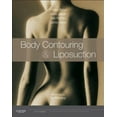 thumbnail image 2 of Body Contouring and Liposuction: Expert Consult - Online and Print, 2 of 3