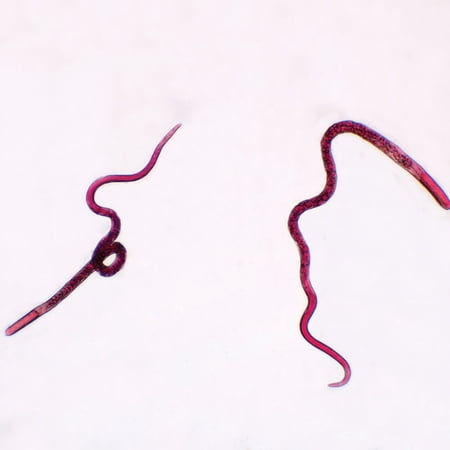 Trichinella Spiralis Female Slide  W.M. price history on PriceWatchPro