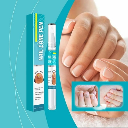 

Nail 3ML Foot And Hand Grey Nail Pen Soft Nail Thick Nail Solution