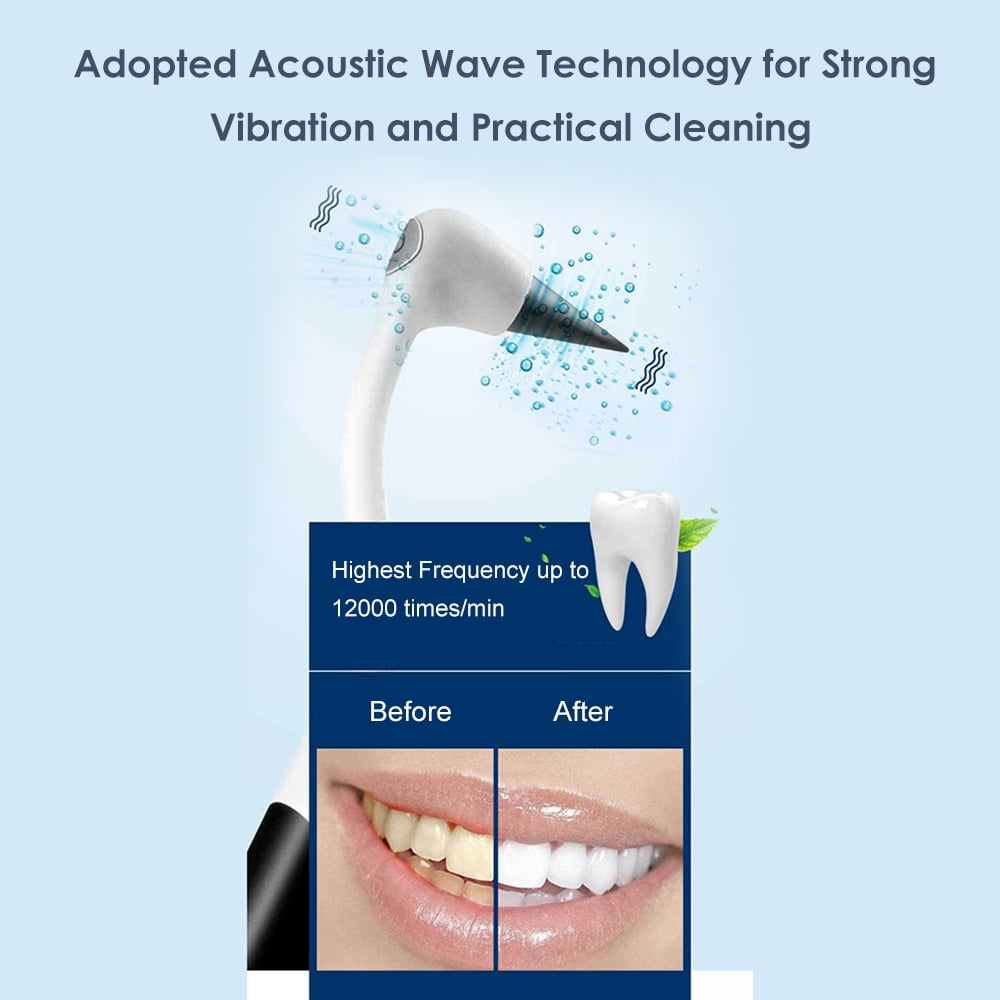 acoustic vibration tooth cleaner