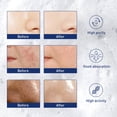 thumbnail image 4 of West&Month Exfoliating Mousse, Cleanser Skin Pore Control Oil Gently Cleanses Exfoliating Dead Blackheads, 4 of 6