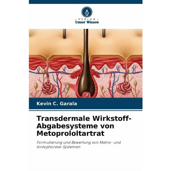 Transdermale Wirkstoff-Abgabesysteme von Metoprololtartrat, (Paperback)