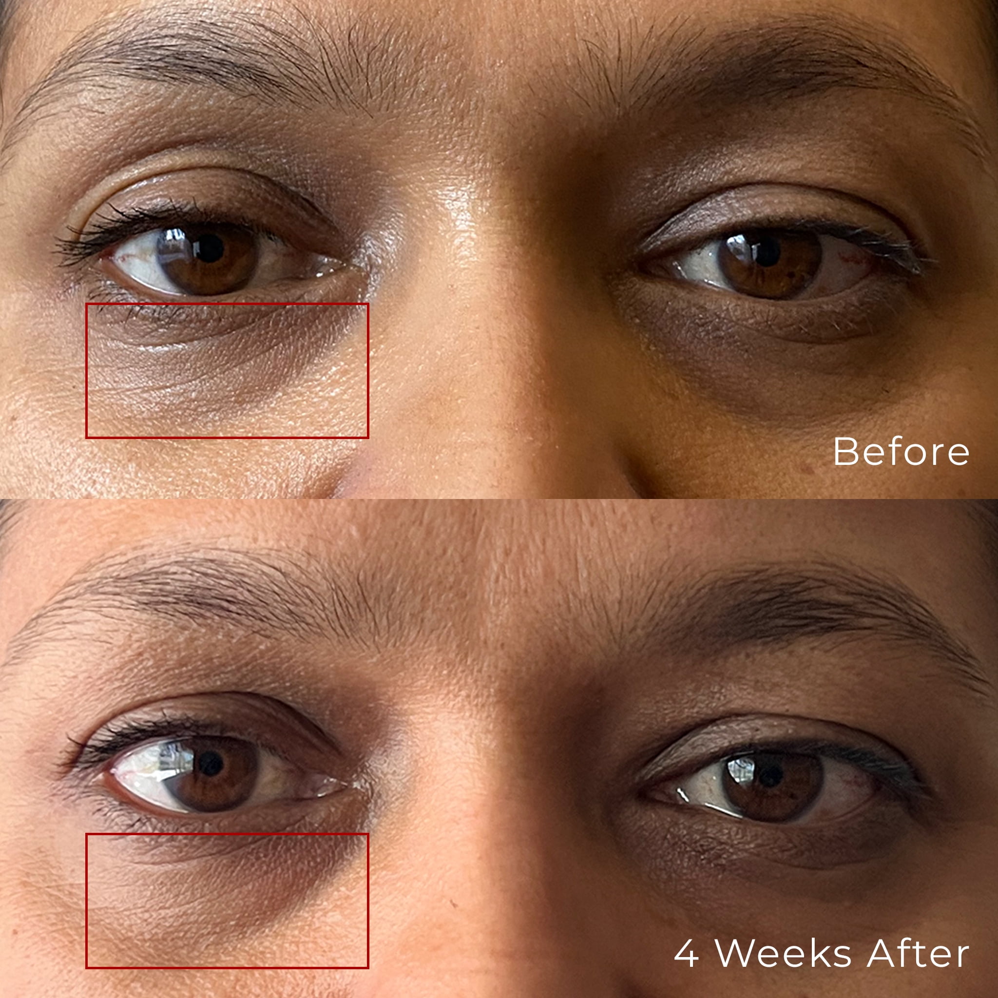Peptide Eye Gel - Under Eye Cream with Multiple Peptides, Depuff, Remove Dark Circles, Wrinkles, Cucumber, Licorice Root - 12 Ml