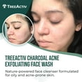 thumbnail image 3 of TreeActiv Charcoal Acne Exfoliating Face Wash, Acne Prone Skin Face Wash, Natural Face Wash for Acne, 425 Uses, 3 of 13