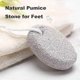 thumbnail image 3 of 2PCS Natural Pumice Stone,Small Callus Remover Pedicure Tools Hard Skin Callus Remover for Feet and Hands, Foot File Exfoliation to Remove Dead Skin,a, 3 of 5