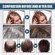 thumbnail image 2 of OUHOE dense hair essence spray anti-drop solid hair repair hair dry and frizz moisturizing thic, 2 of 5