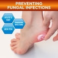 thumbnail image 7 of MED PRIDE Antifungal Cream 1% Clotrimazole – Antifungal Ointment for Jock Itch, Athlete’s Foot & Ringworm, Foot Fungus Treatment Relieves Itching 1oz, 7 of 7