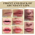 thumbnail image 3 of Beauty Lip Essence Beauty Lip Essential Oil Dudu Lip Black Lip Tender Lip Artifact Removes Black Lip Color And Dilutes Lip Line, 3 of 3