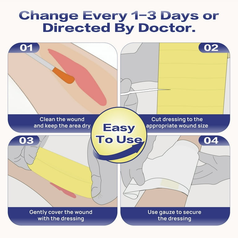 surgical mesh dressing Amazon.com: Xeroform Petrolatum Dressing Non-Adherent Occlusive Fine Mesh Gauze Pad, Gentle Patch for Burns, Laceration, Surgical Incisions & Skin Grafts (2"x2" Pack of 25) : Industrial & Scientific