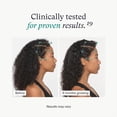 thumbnail image 4 of Suplementos para el crecimiento del cabello Nutrafol Women Vegan 2 Month, 4 of 9