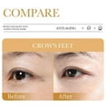 thumbnail image 5 of Collagen Face Mask, Collagen Anti-Aging Mask, Wrinkle-Removing Mask, Anti-Wrinkle Hydrating Facial Mask, 5pcs, 5 of 10