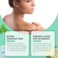 thumbnail image 4 of Face Care Scar Helps Promote Skin Cell Scar Helps To Even Out Skin Tone Reduce Help You Skin Tone And Improve Overall Skin Quality, 4 of 8