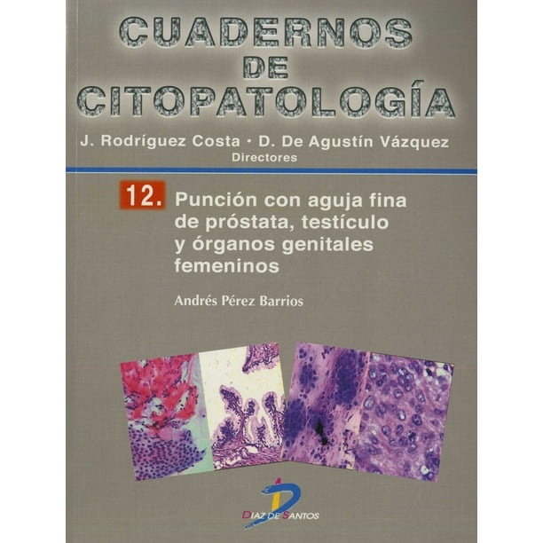 PUNCION CON AGUJA FINA DE PROSTATA, TESTICULO Y ORGANOS GENITALES FEMENINOS EDICIONES DIAZ DE SANTOS ANDRES PEREZ BARRIOS