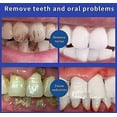 thumbnail image 3 of Sp 6 Toothpaste, Ultra Whitening Toothpaste Sp-6, Sp-6 Ultra Whitening Probiotic Brightening Toothpaste, Fresh Breath Stain Removal, 3 of 4
