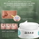 thumbnail image 5 of Crema de melasma, crema para manchas blancas, crema para eliminar manchas oscuras de melasma, elimina rápidamente el melasma, 5 of 5