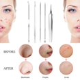 thumbnail image 3 of Outil de Suppression des Imperfections des Points Blancs Kit d'Outils Popper 8 Pcs, 3 of 5