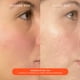 thumbnail image 3 of Crema hidratante Tower 28 Beauty SOS Daily Skin Barrier 50 ml, 3 of 6