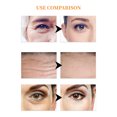 thumbnail image 3 of Vogacara Parches para los ojos Anti-envejecimiento Hialurónico Hidratante Reafirmante Máscaras para los ojos Cuidado de la piel Antiarrugas Cuidado de ojos, 3 of 6