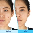 thumbnail image 3 of Set de Cuidado de la Piel Differin Gel 3 Paso en SPF 30 para Rostro, Limpiador Facial para Piel Sens, 3 of 8