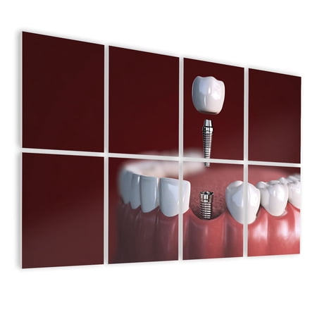 Dental 8 Pack Art Acoustic Panels Sound Absorbing Dental Implant Installing Rebuild tooth root canal treatment Decorative Soundproof Wall Panels Self Adhesive for Physician Hospital Office 48 x32