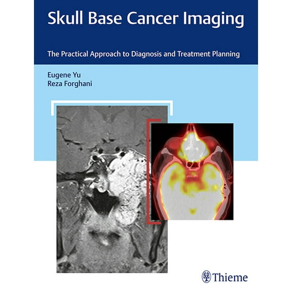 Skull Base Cancer Imaging: The Practical Approach to Diagnosis and Treatment Planning (Hardcover)