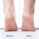 thumbnail image 4 of Herramientas profesionales para el cuidado de los pies raspador de pies Afortunado Sencillez, 4 of 5