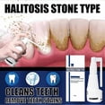 thumbnail image 4 of Aerosol disolvente dental removedor de sarro 2 piezas yuxing, 4 of 5