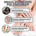 thumbnail image 3 of Medinail Fungus Spray,Toenail Fungus Treatment,Nail Fungus Treatment For Toenail, 3 of 5