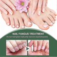 thumbnail image 2 of Extra stark nagelsvampbehandling, bsta nagelreparation stoppa svamptillvxt Effectiv_i*, 2 of 4