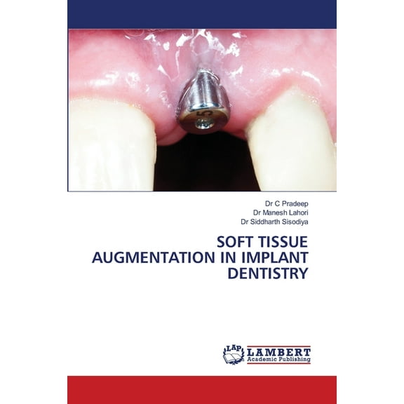 Soft Tissue Augmentation in Implant Dentistry, (Paperback)