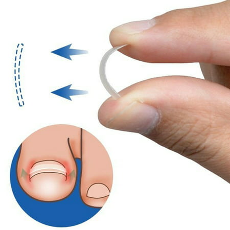 ZeAofa 10Pcs Ingrown Toenail Straightening Clip Curved Brace Toenails Correction (Best Medicine For Ingrown Toenail)